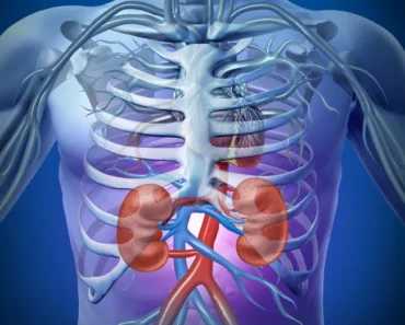 Kidney Stones Treatment: Best Natural Remedies for Great Relief