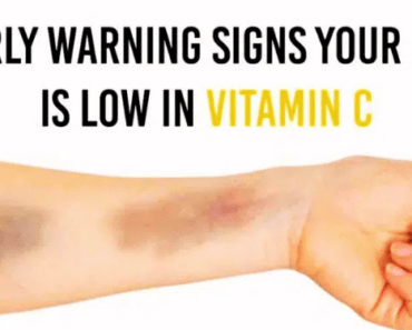 7 Early Warning Signs You’re Running Low on Vitamin C