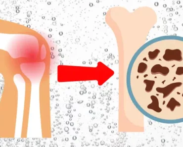 This Common Beverage Slowly Destroys Your Bones, and You’re Probably Drinking It Now