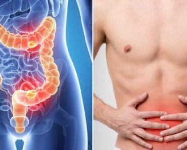 Here Are Ways to Successfully Remove Toxins in your Colon