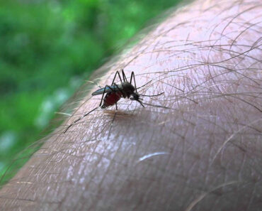 Mosquito Bites: 14 Effective Natural Home Remedies