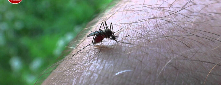 Mosquito Bites: 14 Effective Natural Home Remedies