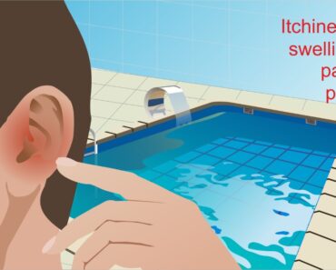 Swimmer’s Ear: 4 Natural Remedies, Diet, and Prevention