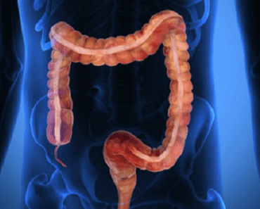 Wellness The Benefits of a Proper Colon Cleanse