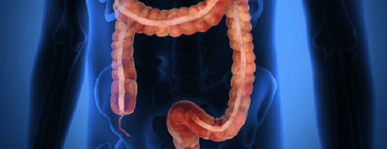 Wellness The Benefits of a Proper Colon Cleanse