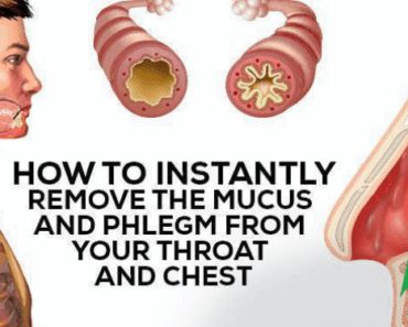 How to Naturally Eliminate Phlegm and Mucus From Your Chest and Throat—Fast and Effectively!