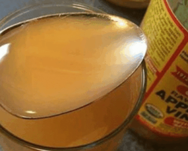 I Took 1 TBSP of Apple Cider Vinegar for 60 Days — The Results Were Shocking