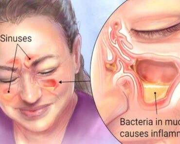 Kill Sinus Infections in 20 Seconds With This Simple Method and Common Household Ingredient