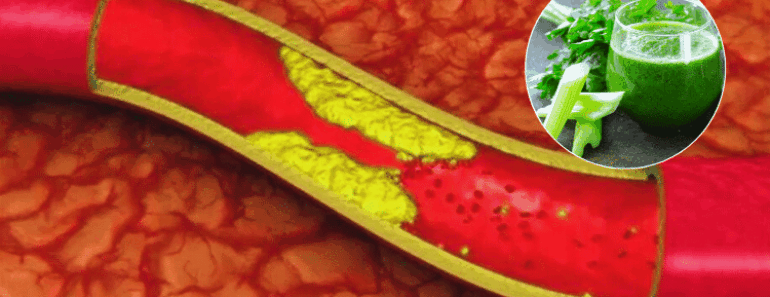 Could This Natural Remedy Be the Easiest Way to Lower Cholesterol?