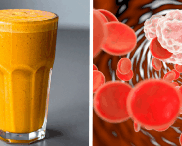 Mix Turmeric, Honey, and Milk to Fight Inflammation and Strengthen Immunity Mix Turmeric, Honey, and Milk to Fight Inflammation and Strengthen Immunity