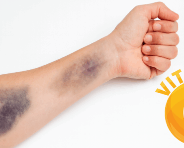 Your Body Might Be Low in Vitamin C – Here Are 9 Subtle Warnings You Shouldn’t Ignore Your Body Might Be Low in Vitamin C – Here Are 9 Subtle Warnings You Shouldn’t Ignore