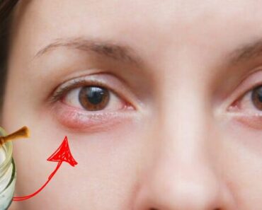 She Rubbed Coconut Oil Around Her Eyes—5 Minutes Later, The Results Left Everyone Stunned!