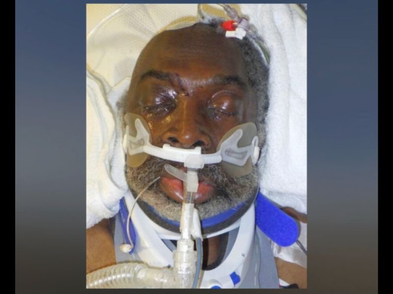 Hospital Urgently Seeks Public&rsquo;s Help Identifying Unconscious 65-Year-Old Man Found Injured in Los Feliz